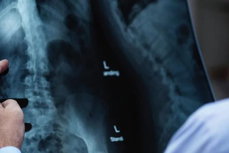 1 yıldır yemek yiyemeyen adamın midesinin röntgeni çekildi, doktor hemen ekibini topladı!