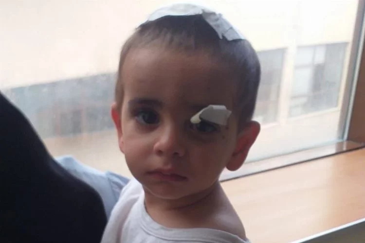 Köpeklerin saldırdığı 2 yaşındaki Ali Asaf'tan acı haber...
