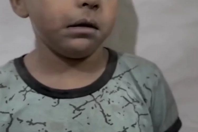 Yürek burkan görüntüler! Filistinli doktor korkudan titreyen çocuğu böyle sakinleştirmeye çalıştı...